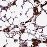 Immunohistochemistry (Formalin/PFA-fixed paraffin-embedded sections) - Anti-HEATR3 antibody (AB122762)