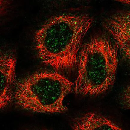 Immunocytochemistry/ Immunofluorescence - Anti-HEATR5B antibody (AB220780)