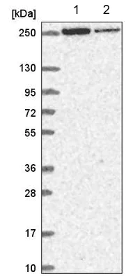 Western blot - Anti-HEATR5B antibody (AB220780)