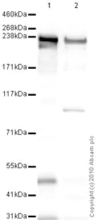 Western blot - Anti-heavy chain cardiac Myosin antibody [BA-G5] (AB50967)