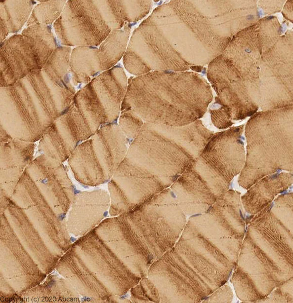 Immunohistochemistry (Formalin/PFA-fixed paraffin-embedded sections) - Anti-heavy chain Myosin antibody (AB124205)
