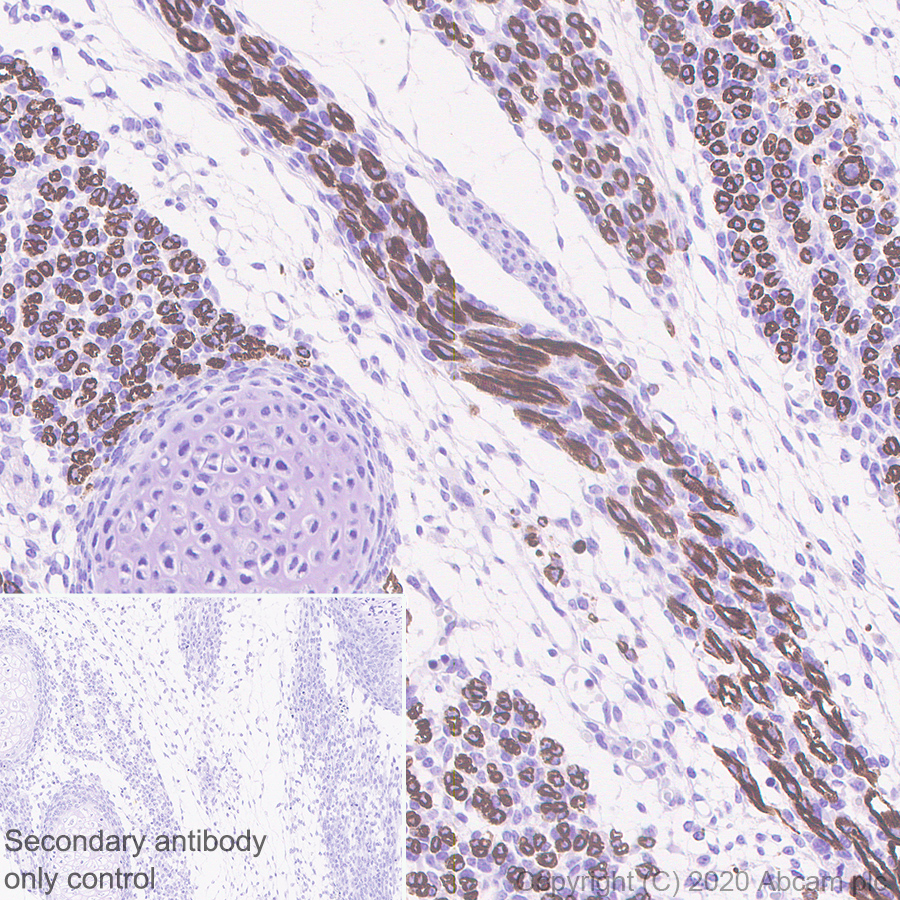 Immunohistochemistry (Formalin/PFA-fixed paraffin-embedded sections) - Anti-heavy chain Myosin antibody [F1.652] - BSA and Azide free (AB264039), expandable thumbnail