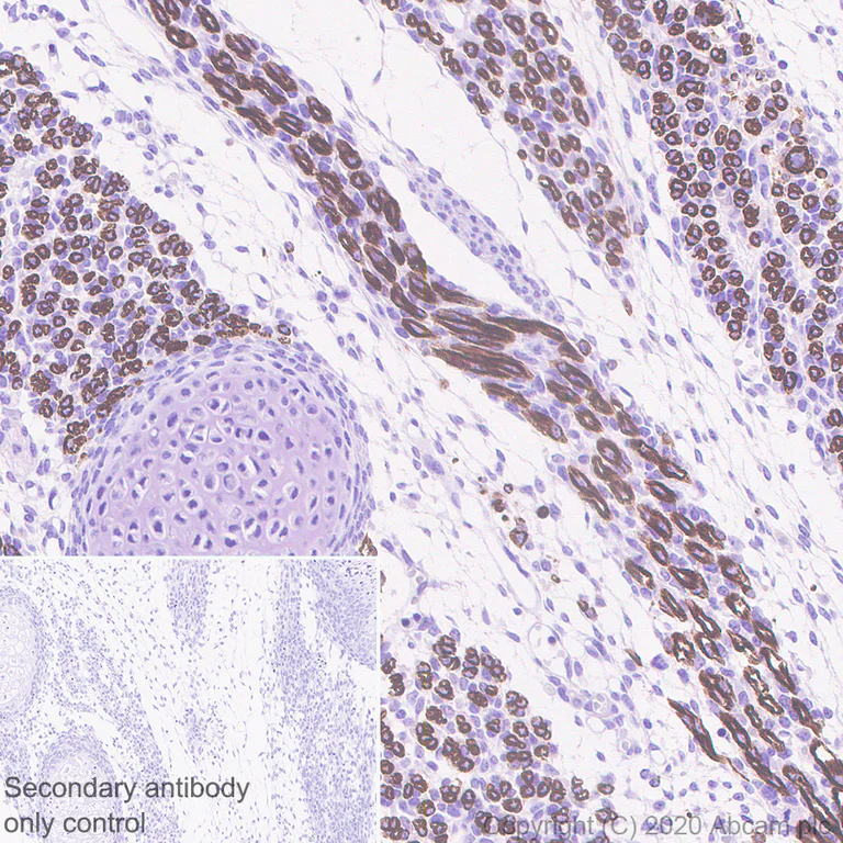 Immunohistochemistry (Formalin/PFA-fixed paraffin-embedded sections) - Anti-heavy chain Myosin antibody [F1.652] - BSA and Azide free (AB264039)