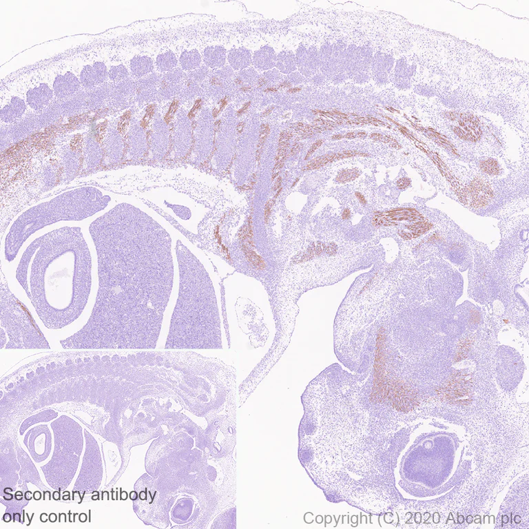 Immunohistochemistry (Formalin/PFA-fixed paraffin-embedded sections) - Anti-heavy chain Myosin antibody [F1.652] - BSA and Azide free (AB264039)