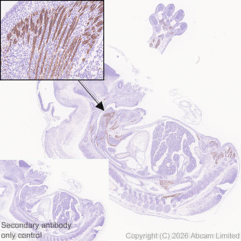 Immunohistochemistry (Formalin/PFA-fixed paraffin-embedded sections) - Anti-heavy chain Myosin/MYH3 antibody [EPR29772-555] (AB325795)