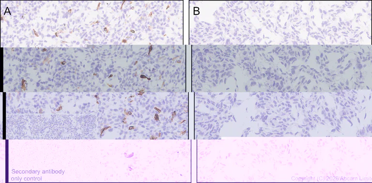 Immunohistochemistry (Formalin/PFA-fixed paraffin-embedded sections) - Anti-heavy chain Myosin/MYH3 antibody [EPR29772-555] (AB325795)