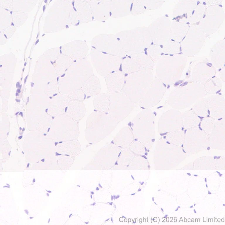 Immunohistochemistry (Formalin/PFA-fixed paraffin-embedded sections) - Anti-heavy chain Myosin/MYH3 antibody [EPR29772-555] (AB325795)