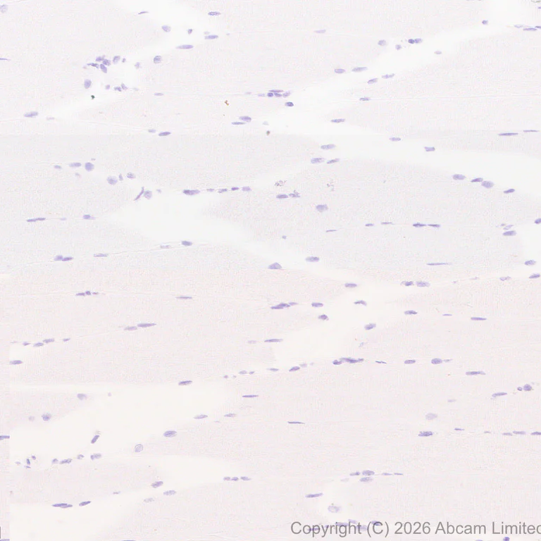Immunohistochemistry (Formalin/PFA-fixed paraffin-embedded sections) - Anti-heavy chain Myosin/MYH3 antibody [EPR29772-555] (AB325795)