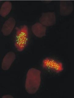 Immunocytochemistry/ Immunofluorescence - Anti-HEC1/HEC antibody [9G3] (AB3613)