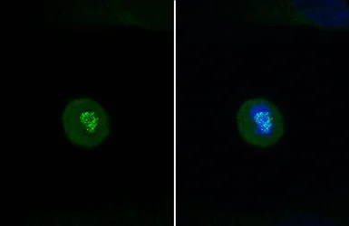 Immunocytochemistry/ Immunofluorescence - Anti-HEC1/HEC antibody [9G3] (AB3613)