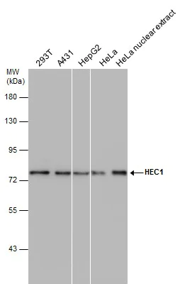 Western blot - Anti-HEC1/HEC antibody [9G3] (AB3613)