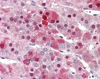 Immunohistochemistry (Formalin/PFA-fixed paraffin-embedded sections) - Anti-HEC1/HEC antibody (AB117415)