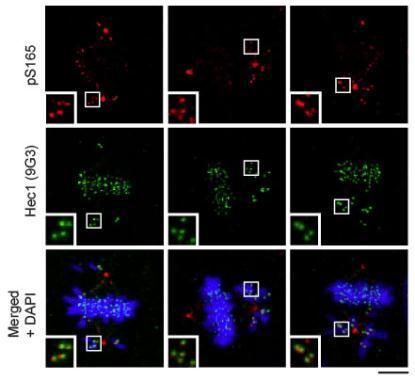 Immunocytochemistry/ Immunofluorescence - Anti-HEC1/HEC (phospho S165) antibody (AB233459)