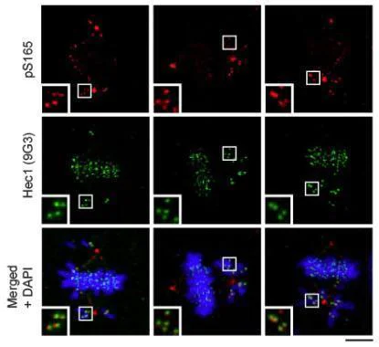 Immunocytochemistry/ Immunofluorescence - Anti-HEC1/HEC (phospho S165) antibody (AB233459)