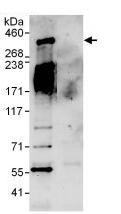 Immunoprecipitation - Anti-HECTD1 antibody (AB101992), expandable thumbnail