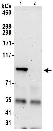 Immunoprecipitation - Anti-HECTD3 antibody (AB241413)