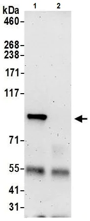 Immunoprecipitation - Anti-HECTD3 antibody (AB241413)