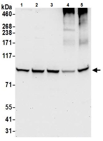 Western blot - Anti-HECTD3 antibody (AB241413)