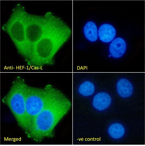 Immunocytochemistry/ Immunofluorescence - Anti-HEF1/NEDD-9 antibody [2G9] (AB18056)