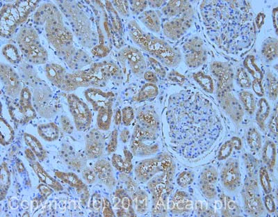 Immunohistochemistry (Formalin/PFA-fixed paraffin-embedded sections) - Anti-HEF1/NEDD-9 antibody [2G9] (AB18056)