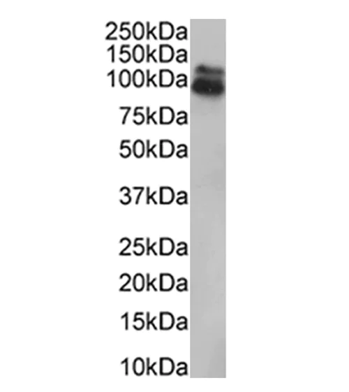 Western blot - Anti-HEF1/NEDD-9 antibody [2G9] (AB18056)