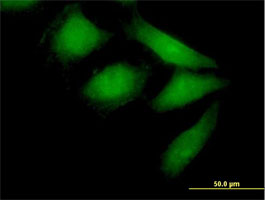 Immunocytochemistry/ Immunofluorescence - Anti-HEF1/NEDD-9 antibody (AB88584)