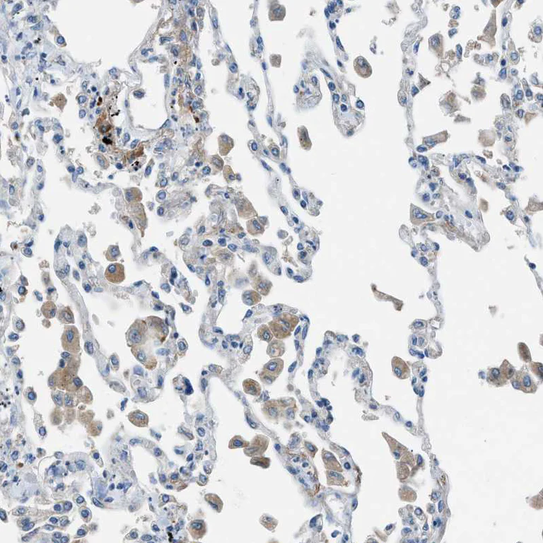 Immunohistochemistry (Formalin/PFA-fixed paraffin-embedded sections) - Anti-HEG1 antibody (AB121343)