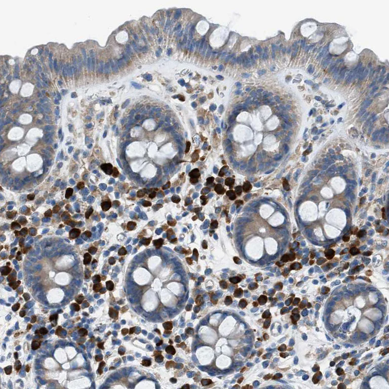 Immunohistochemistry (Formalin/PFA-fixed paraffin-embedded sections) - Anti-HEG1 antibody (AB121343)