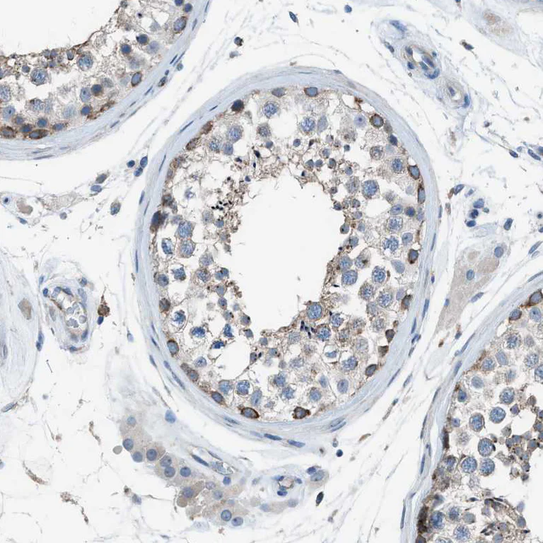Immunohistochemistry (Formalin/PFA-fixed paraffin-embedded sections) - Anti-HEG1 antibody (AB121343)