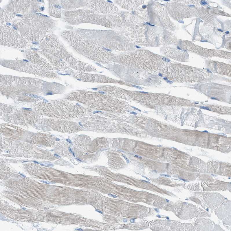 Immunohistochemistry (Formalin/PFA-fixed paraffin-embedded sections) - Anti-HEG1 antibody (AB121343)