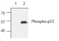 Western blot - HeLa DNA Damage Whole Cell Lysate Set: UV Treated and Untreated Control (AB157396)