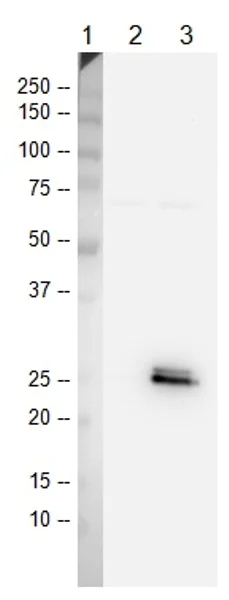 Western blot - HeLa DNA Damage Whole Cell Lysate Set: UV Treated and Untreated Control (AB157396)