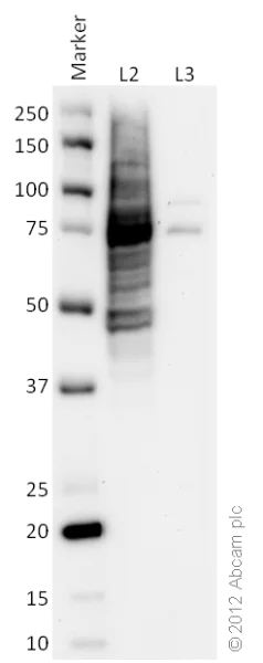 Western blot - HeLa Ser/Thr Phosphatase-Inhibited Whole Cell Lysate Set: Calyculin-Treated and Vehicle-Treated (AB135395)