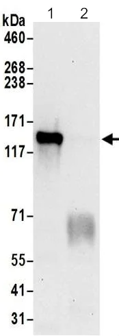 Immunoprecipitation - Anti-HELB antibody - C-terminal (AB202141)