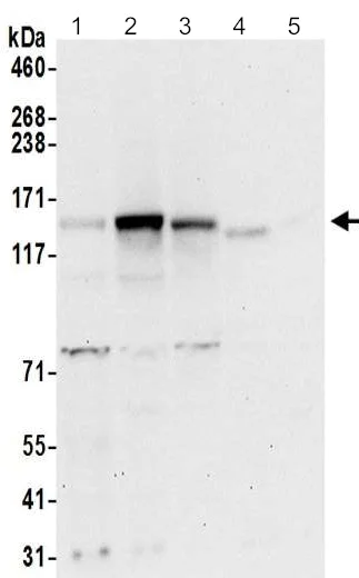 Western blot - Anti-HELB antibody - C-terminal (AB202141)