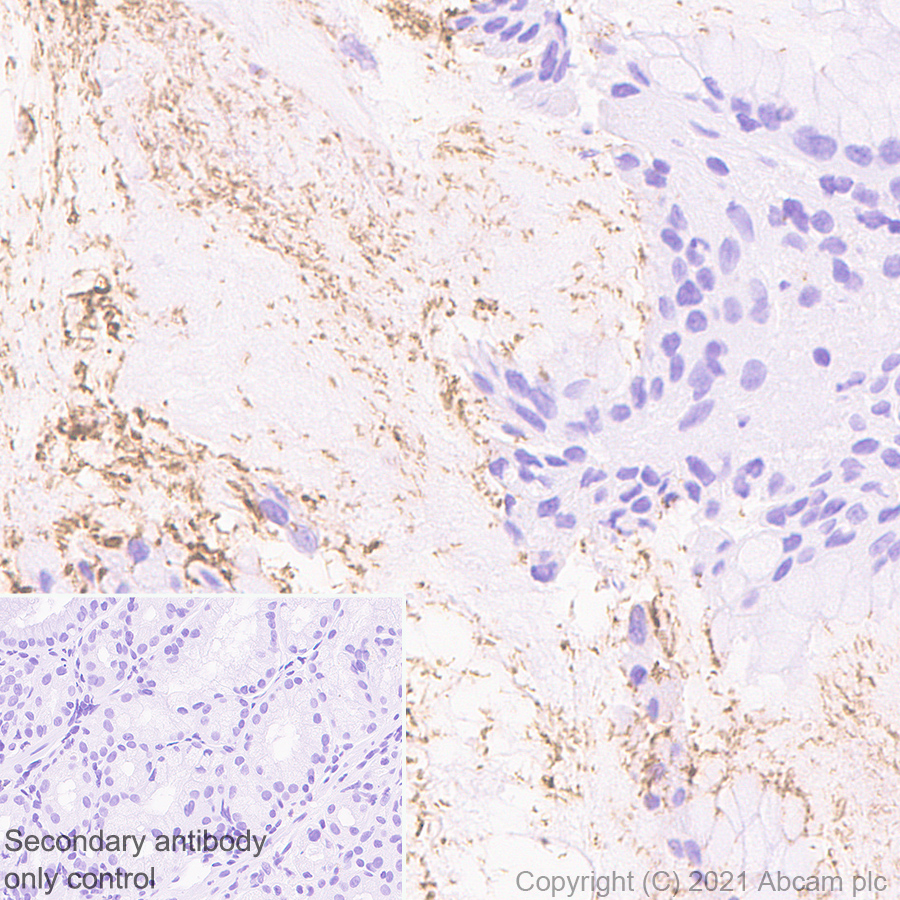 Immunohistochemistry (Formalin/PFA-fixed paraffin-embedded sections) - Anti-Helicobacter pylori antibody [EPR10353] (AB172611), expandable thumbnail