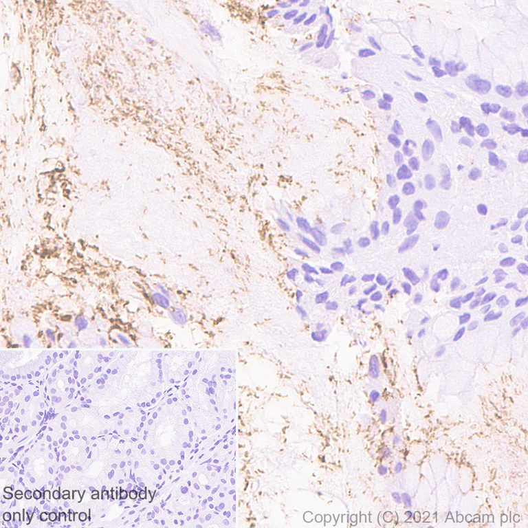 Immunohistochemistry (Formalin/PFA-fixed paraffin-embedded sections) - Anti-Helicobacter pylori antibody [EPR10353] - BSA and Azide free (AB210851)