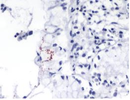 Immunohistochemistry (Formalin/PFA-fixed paraffin-embedded sections) - Anti-Helicobacter pylori antibody [SPM526] (AB231433)