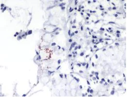 Immunohistochemistry (Formalin/PFA-fixed paraffin-embedded sections) - Anti-Helicobacter pylori antibody [SPM526] (AB231433)