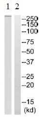 Western blot - Anti-HELZ2 antibody (AB129781), expandable thumbnail
