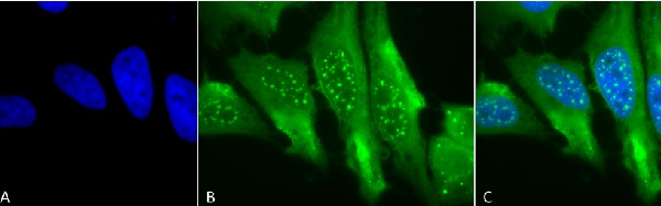 Immunocytochemistry/ Immunofluorescence - Anti-Heme Oxygenase 1 antibody [1F12-A6] (AB223349), expandable thumbnail