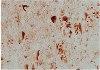 Immunohistochemistry (Formalin/PFA-fixed paraffin-embedded sections) - Anti-Heme Oxygenase 1 antibody (AB13243), expandable thumbnail