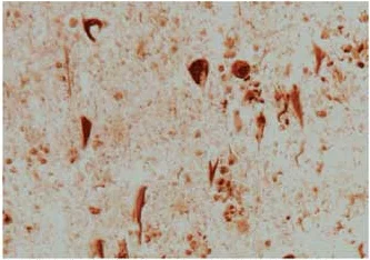 Immunohistochemistry (Formalin/PFA-fixed paraffin-embedded sections) - Anti-Heme Oxygenase 1 antibody (AB13243)