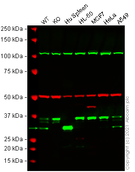 Western blot - Anti-Heme Oxygenase 1 antibody [EP1391Y] (AB52947), expandable thumbnail