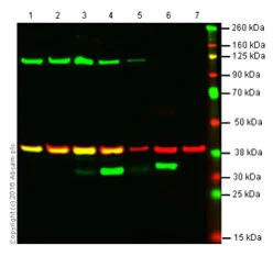 Western blot - Anti-Heme Oxygenase 1 antibody [EP1391Y] (AB52947)
