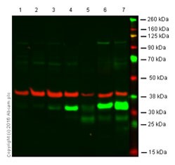 Western blot - Anti-Heme Oxygenase 1 antibody [EPR1390Y] (AB68477), expandable thumbnail