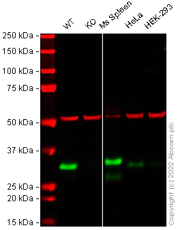 Western blot - Anti-Heme Oxygenase 1 antibody [EPR18161-128] (AB189491)