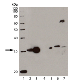 Western blot - Anti-Heme Oxygenase 1 antibody [HO-1-1] (AB13248), expandable thumbnail