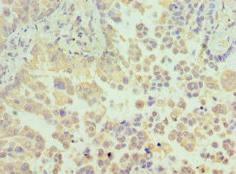 Immunohistochemistry (Formalin/PFA-fixed paraffin-embedded sections) - Anti-HEMK2/N6AMT1 antibody (AB238897)