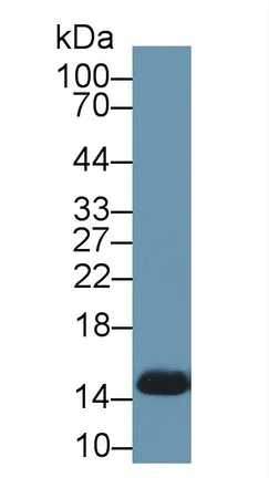 Western blot - Anti-Hemoglobin antibody (AB231584)